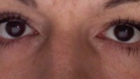 mylashes1