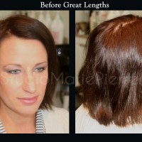 before-gl-w1